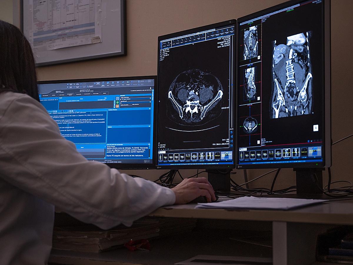 A clinician at a desk reviewing CT scans of the spine and pelvis across three monitors, with the radiology report open on the screen at left